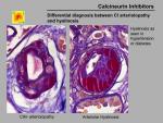 img-Calcineurin inhibitors-0043.jpg